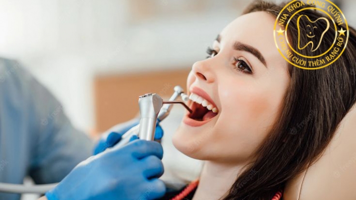 Tái khám định kỳ và bảo dưỡng Implant sau khi hoàn tất phục hình