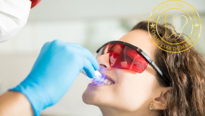 Tẩy trắng răng kết hợp: Giải pháp toàn diện cho nụ cười sáng khỏe