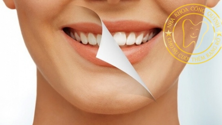 “Nụ cười Giáng Sinh” – Bí quyết làm trắng răng an toàn trước lễ