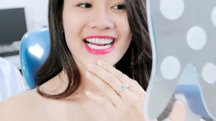 Tẩy trắng răng đầu năm: nâng diện mạo mà không cần chỉnh sửa gì