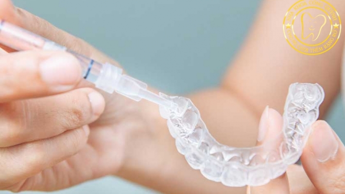 Hướng dẫn sử dụng máng tẩy trắng