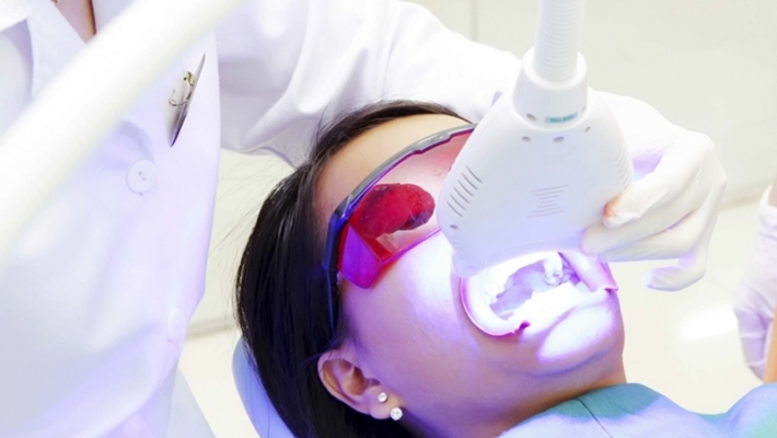 Tẩy trắng răng tại phòng nha bằng đèn Plasma: Có hiệu quả không?