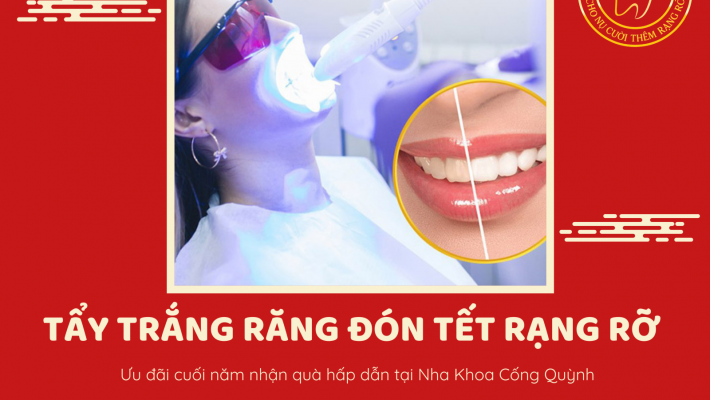 LÀM TRẮNG RĂNG ĐÓN TẾT – NHẬN QUÀ XỊN TẠI NHA KHOA CỐNG QUỲNH