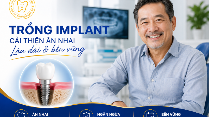 Trồng Implant có giúp cải thiện khả năng ăn nhai lâu dài