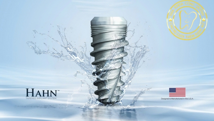 Có nên chọn Implant Mỹ khi cần phục hồi răng mất? Ưu điểm, độ bền, khả năng tích hợp xương