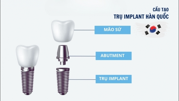 Implant Brat, Osstem, Dentium, ...(HQ)