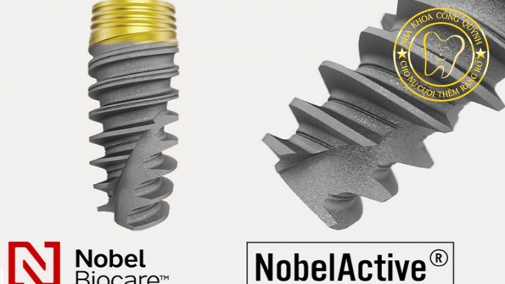 Công nghệ Implant Mỹ – Lựa chọn an toàn cho người lớn tuổi và bệnh lý nền