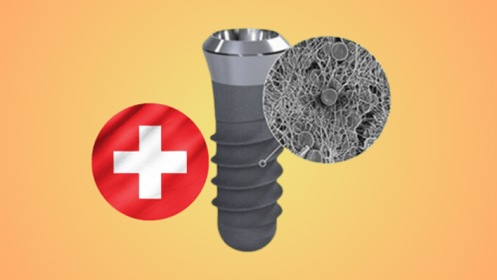 Trụ Implant Thụy Sĩ – Bảo hành toàn cầu, an tâm tuyệt đối