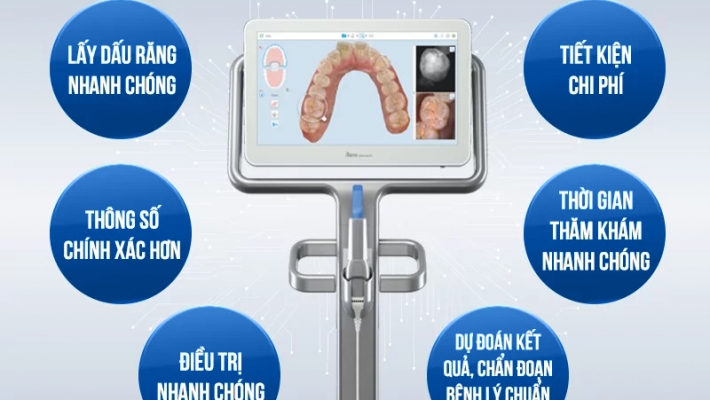 CÔNG NGHỆ SCAN 3D iTero – Trải nghiệm chuẩn xác cho khách hàng chỉnh nha Invisalign tại Nha Khoa Cống Quỳnh