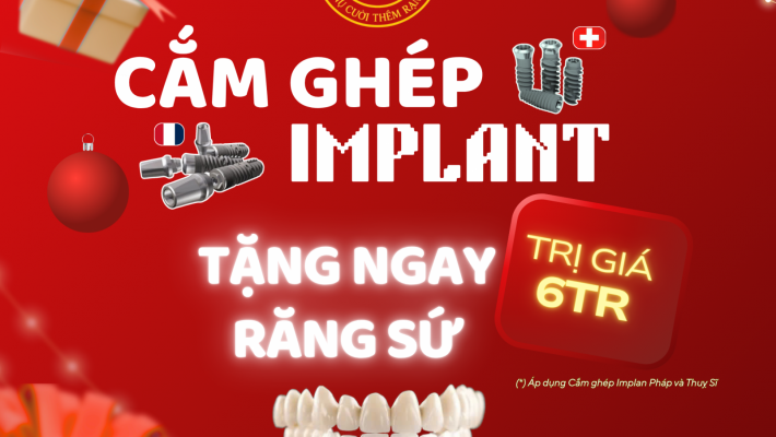 CẮM GHÉP IMPLANT – TẶNG RĂNG SỨ TRỊ GIÁ 6 TRIỆU
