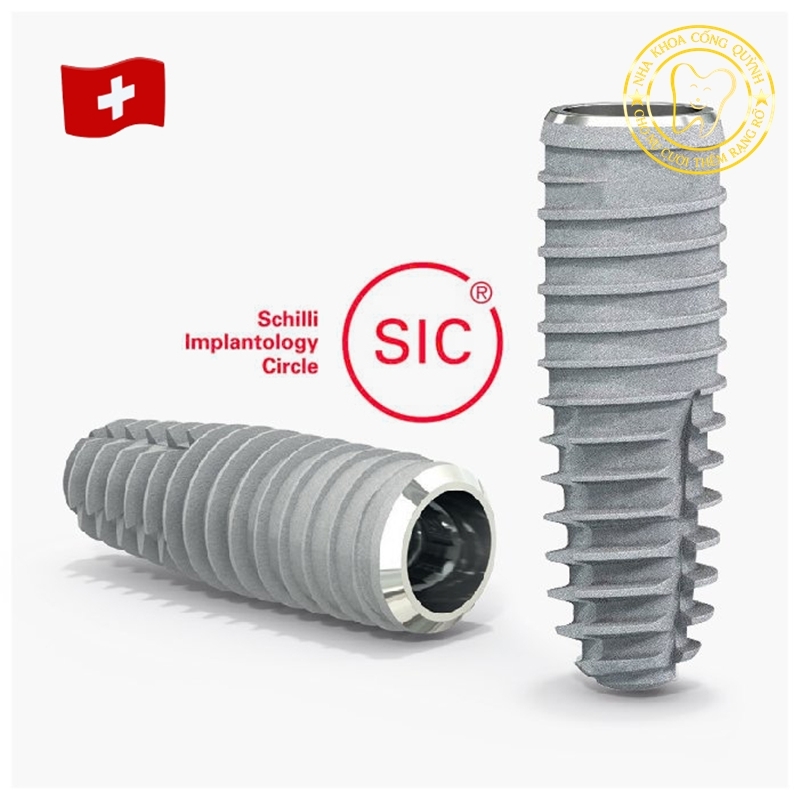 Implant SIC phù hợp với ai? Những trường hợp bác sĩ ưu tiên lựa chọn
