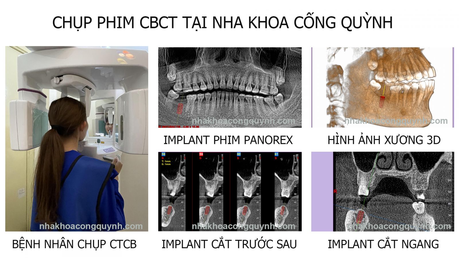NHA KHOA CỐNG QUỲNH