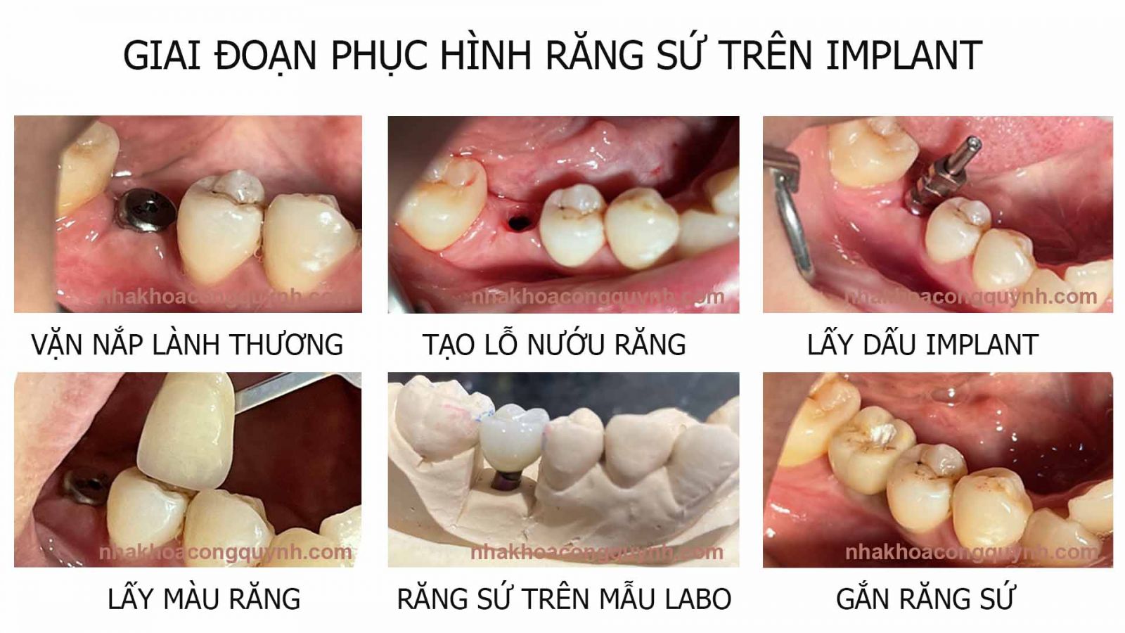 NHA KHOA CỐNG QUỲNH