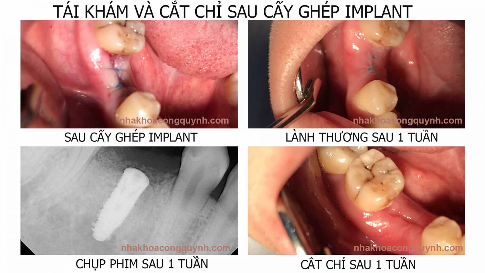 NHA KHOA CỐNG QUỲNH